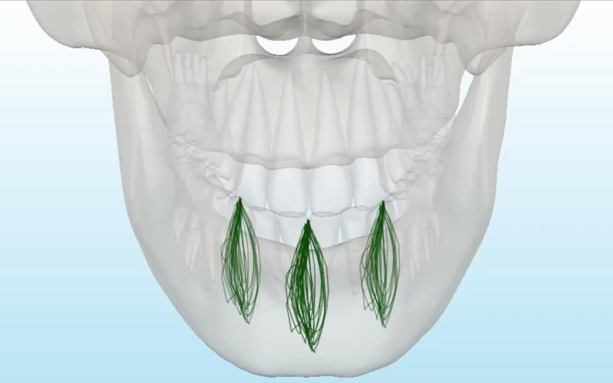 顎関節症-コンピューター診断と噛み合わせ調整 | 高坂デンタルオフィス