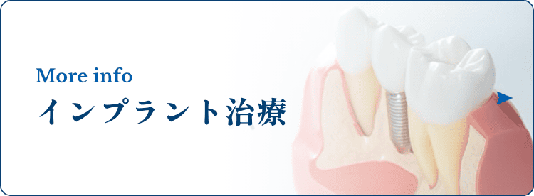 インプラント治療