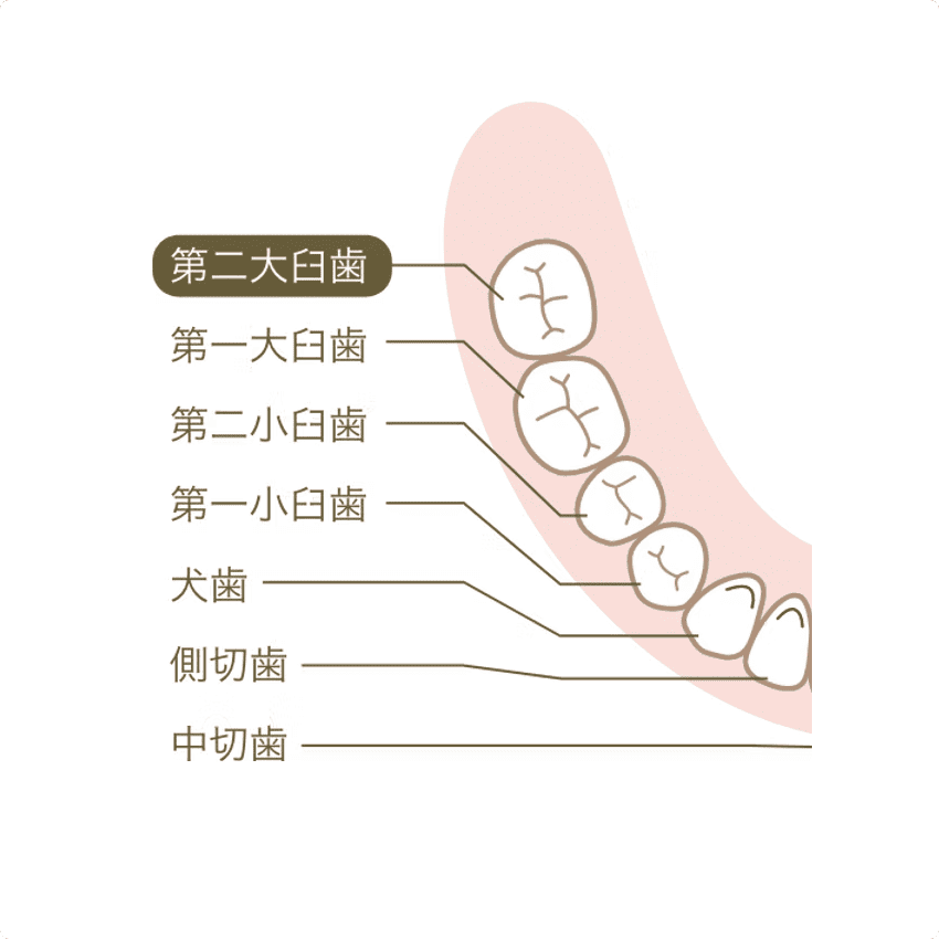 ブリッジを選択することで何が起こるか
